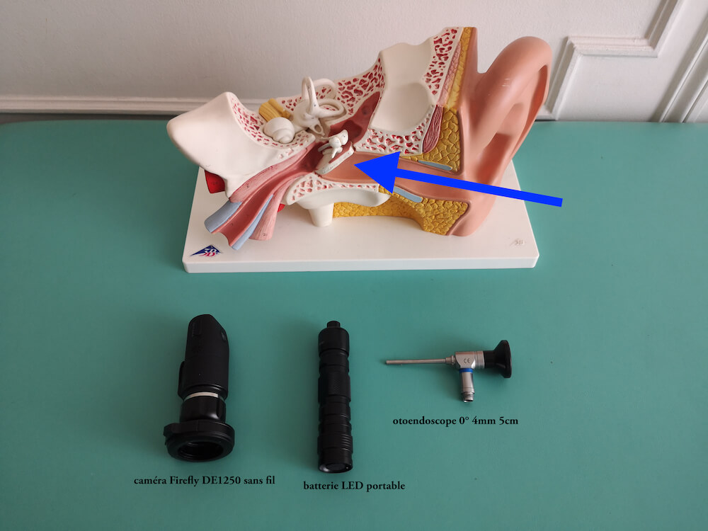 Otorhinolaryngologiste Utilise L'otoscope Pour Examiner Les