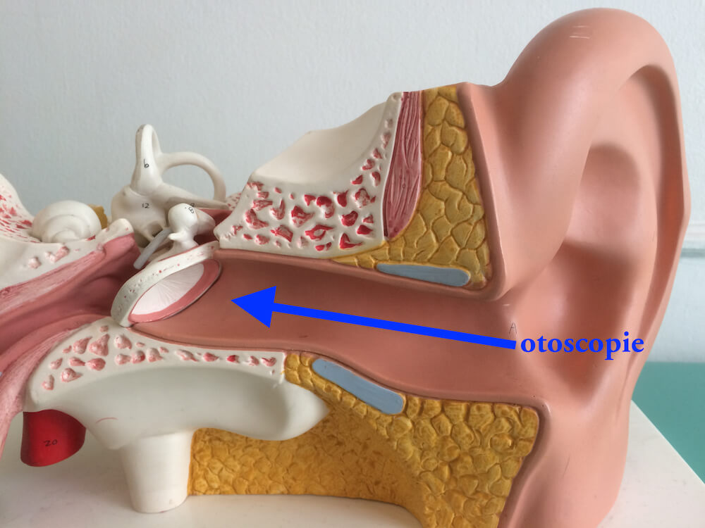 Examen médical de l'oreille avec diapason et otoscope