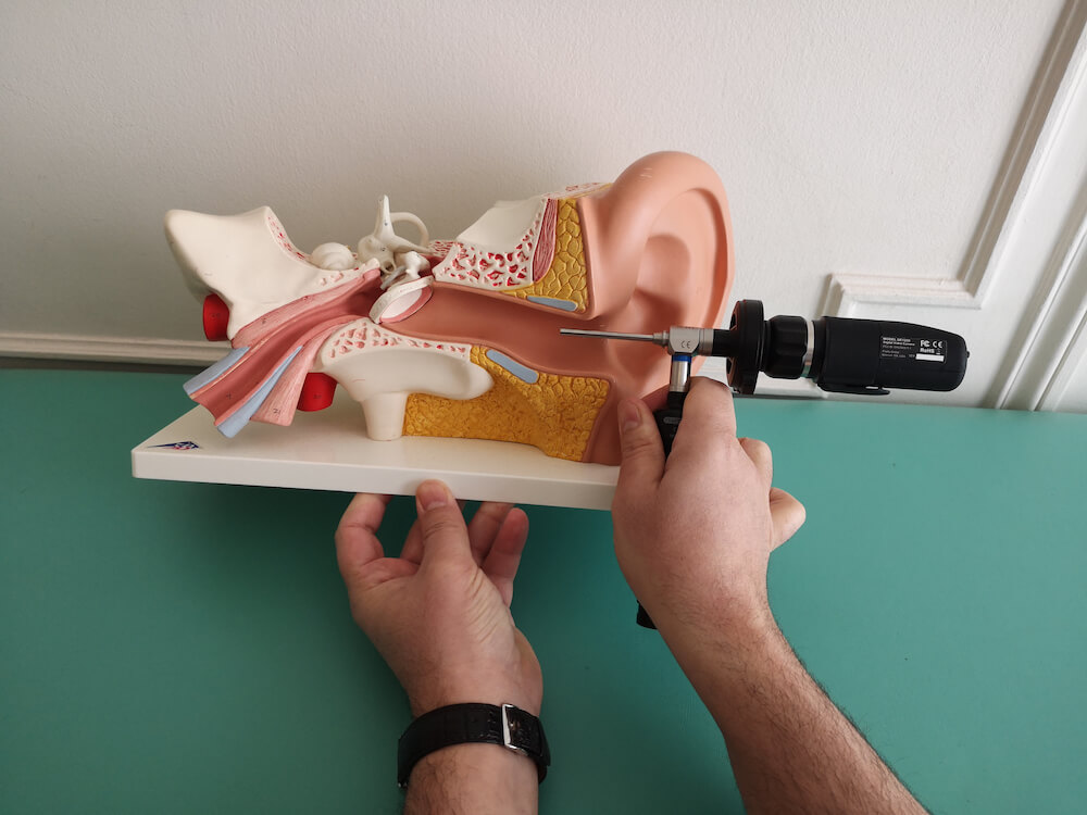 11 3 Maquette avec otoscope1