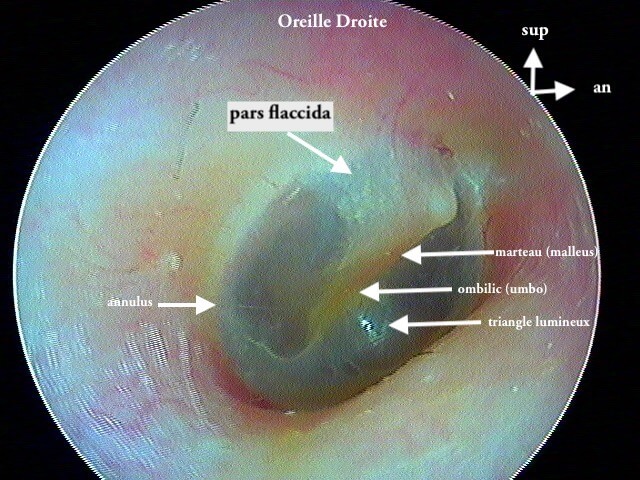 Tutoriel d'otoscopie pour les médecins