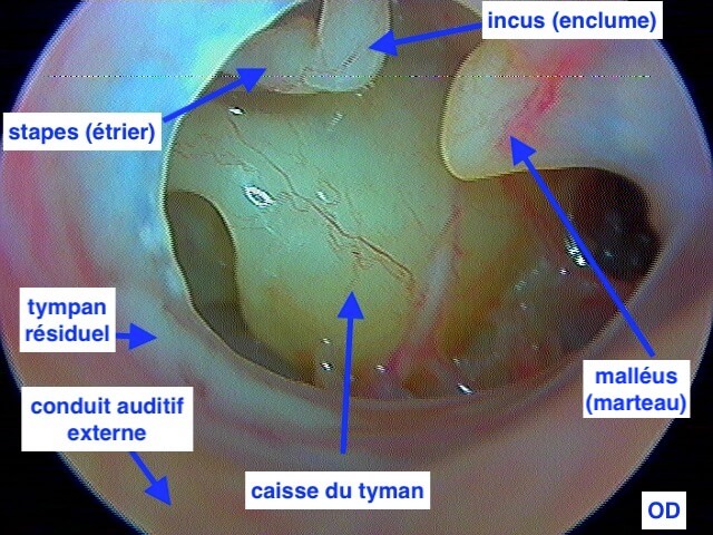 Examen En Gros Plan De L'oreille De L'enfant Avec Otoscope