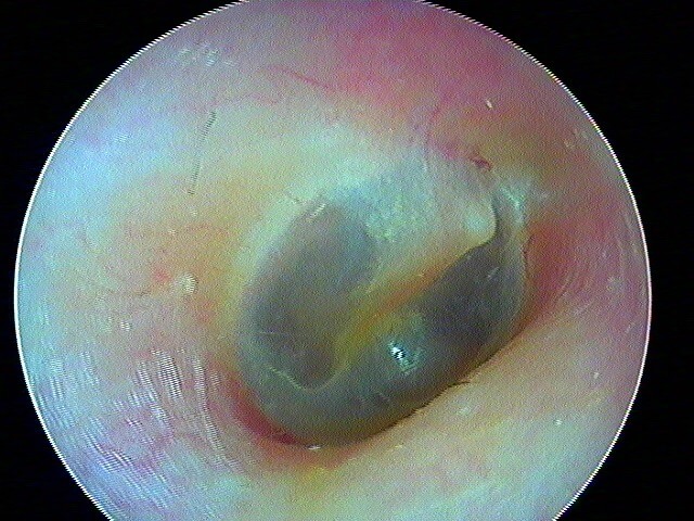 Le Médecin Examine L'oreille Avec Un Otoscope Dans Une Chambre De