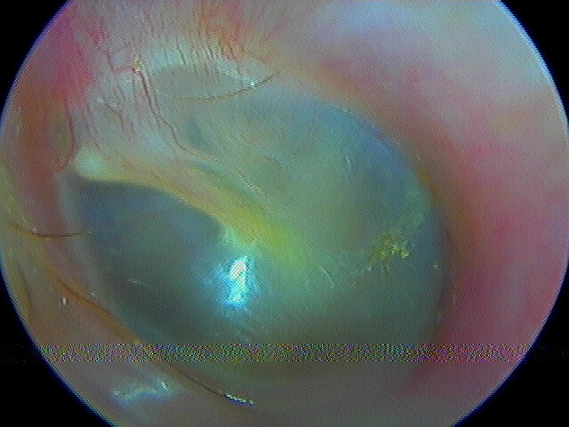 Examen Minutieux De L'oreille Des Enfants Avec Otoscope. Otoscopie