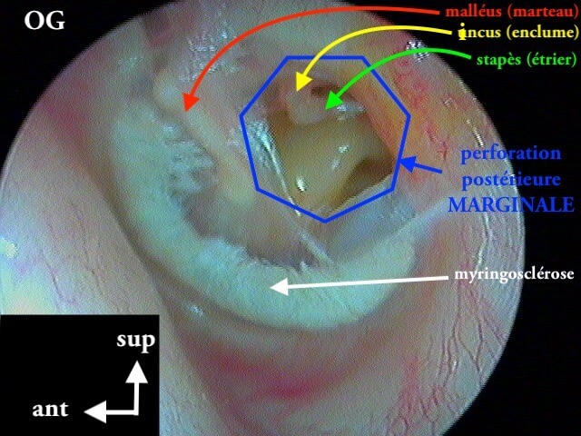 35 140 perfo OG post MARGINALE avec légende suite de 35 139 1