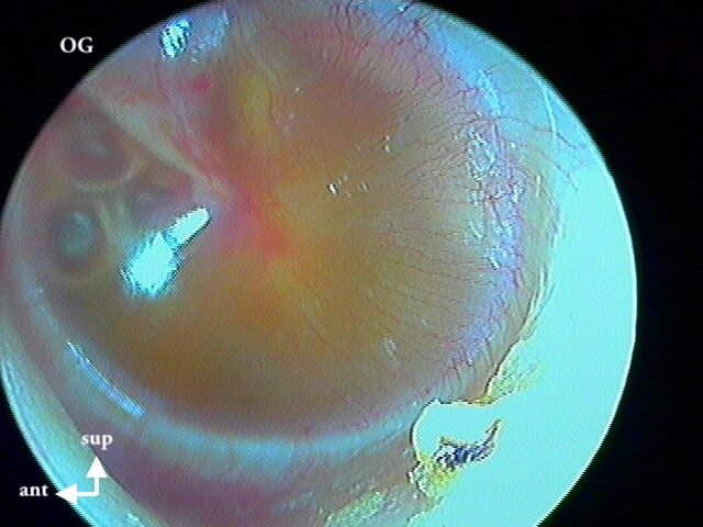 5 165 OSM OG plus séreux bulles