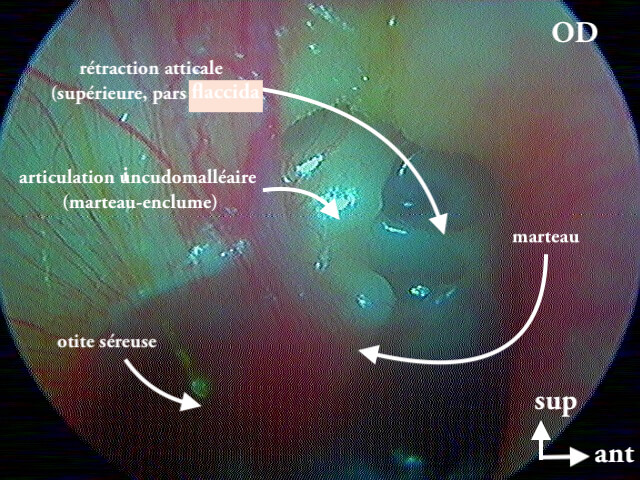 8 200 PdR I OSM OD légende de 8 199 11