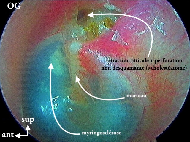 8 201 PdR OG éclatée